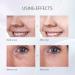 Skin Scrubber Blackhead Remover Set | COSBEAUTY Skin Spatula Exfoliating Scraper with Blackhead Power Liquid | Wireless Charging | IPX6 Waterproof - Buy Online on GoSupps.com