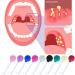 Tonsil Stone Remover Tool | Cupping Glass for Almond Stones | Effective Oral Care for Fresh Breath - Buy Online on GoSupps.com