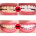 Sp-6 Ultra Whitening Toothpaste Upgraded Sp-4 Ultra Whitening Sp 6 Toothpaste Pasta De Dientes Sp-6 Sp 6 Ultra Whitening (3PCS) - Buy Online on GoSupps.com