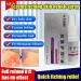 Anti-Itch Eczema Skin Health Spray - Soothes and Relieves Irritated Skin (1pcs) - Buy Online on GoSupps.com