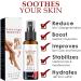 Kolmax Alkyne Psoriasis and Vitiligo Relief Spray - Reduces White Spots on Skin - 3PCS - Buy Online on GoSupps.com