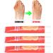 Dauerhaft Toe Swelling Relief Cream - 3pcs 0.7oz Herbal Extract | Safe Bunion Cream for Office Workers | Health Care Solution - Buy Online on GoSupps.com