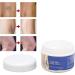 50g Natural Varicose Veins Cream | Leg Circulation & Spider Vein Remover | Cooling Effect | Ointment - Buy Online on GoSupps.com