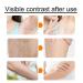 Wax Strip Body Kit | Bikini Waxing for Face & Body | Mild Formula Hair Removal | Zorq Green - Buy Online on GoSupps.com