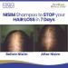 Nisim Hair Loss Treatment ReGrowth Shampoo Conditioner Serum Men Women (1 month supply) - Buy Online on GoSupps.com