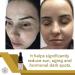 Buy Tonico Aclarante Facial | Best Dark Spot & Blemish Remover | Aqua Labs Colombia - Buy Online on GoSupps.com