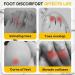 ALREMO Silicone Toe Protectors - 30pcs, Prevent Corns, Blisters & Ingrown Toenails - Buy Online on GoSupps.com