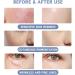 Face Masks Skincare - Hyaluronic Acid Jelly Mask - Face Masks Beauty for Hydrating Smoothing Firming - Skin Care for Jelly Face Mask - Hydrating Face Mask for Face Care - Peel Off Face Masks - Buy Online on GoSupps.com