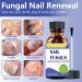 GXGM 1 piece nail care treatment 30 ml nail care serum intensive nail oil for men and women deep care for weakened nails regenerates nail structure repairs cracked and - Buy Online on GoSupps.com