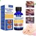 Nail Repair Natural Nail Care Maximum Strength Nail Solution Restores Discolored & Damaged Nails Nail Care Solution - Buy Online on GoSupps.com