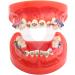 Orthodontic O-Rings & Ties - 40 Transparent Ligature Bonds for Braces | International Shipping - Buy Online on GoSupps.com