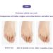 Icehao Toe Valgus Corrector & Bunion Straightener | Joint Pain Relief Aid | 24-Hour Painless Correction | 1 Pair | Complexion - Buy Online on GoSupps.com