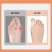 Bunion Corrector Belt - Elastic, Skin-Friendly, Sweat Absorbing, Pain-Relieving - Size Small - Buy Online on GoSupps.com