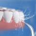 Buy Replacement Tips for Water Flosser & Oral Irrigators - International Shipping Available - Buy Online on GoSupps.com
