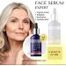 Lorenti 4-in-1 Face Serum 50 ml | Reduces Skin Imperfections Tightens Skin Brightens Revitalizes and Hydrates Skin - Contains Vitamin C - For All Skin Types 1.7 Fl Oz - Buy Online on GoSupps.com