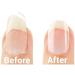 Emjoi Micro Nail Manicure Kit - Smooth, Buff, and Shine Instantly - Buy Online on GoSupps.com