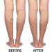 Green Idea Rosskastanien Ointment Gel for Varicose Veins - Leg Cream with Arnica Horse Chestnut & Rutin - 250 ml Pack for Spider Veins & Hemorrhoids - Buy Online on GoSupps.com