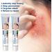 2Pcs Cr mes Contre Le Psoriasis Psoriasis Cream Cr me Base De Plantes Cream Pour Le Corps Pour R duit Des D mangeaisons - Buy Online on GoSupps.com