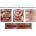 CREADENT Temporary Cosmetic Tooth Replacement Kit - Easy DIY Solution - Buy Online on GoSupps.com