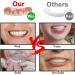 Temporary Tooth Repair Veneers for Missing Teeth - Realistic Upper and Lower Jaw Veneers for Women and Men - Buy Online on GoSupps.com