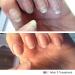 Buy IBX Mini Duo Pack Nail Polish | FREE Dadi Oil | Restore & Protect Your Nails Internationally - Buy Online on GoSupps.com