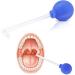 Remove the almond stones removal almond stones cupping glass for removing tonsil stones for a fresh breath (blue)