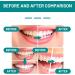 Teeth Whitening Mouthwash Teeth Total Care Mouthwash Helps with Fresh Breath Teeth & Gum Health & More Deep Cleaning of Teeth. (1pcs) - Buy Online on GoSupps.com