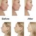 V Line Mask - Contour Lifting Neck Mask for Moisturizing & V-Shaped Facial Care | International Shipping Available - Buy Online on GoSupps.com