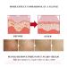 Effective Stretch Marks Removal Cream for Women Targets Pregnancy & Acne Marks Moisturizes & Firms Skin - Buy Online on GoSupps.com