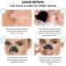 Nosestripes Blackheads Blackhead Nose Strips Deep Cleansing Clear-Up Strips 30 Pieces Nose Strips Pore Strips Anti Nose Stripes Blackheads Remove Blackheads and Impurities - Buy Online on GoSupps.com
