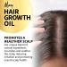 Hair Growth Oil with Rosemary Essential Oil - Rosemary Oil for Hair Growth - Treats Dry Damaged Hair - For Men & Women Promotes Thicker Fuller Hair - 100ml - Made in the UK - Ready to use. - Buy Online on GoSupps.com