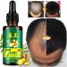  Kingknow Hair Growth Essential Oil Natural Ginger for Hair Loss Treatment Hair Growth Care Ginger Essential Oil Nourishing for Dry Damaged Hair Growth Care 30ml - Buy Online on GoSupps.com