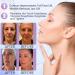  MITHCO Pack of 20 Pdo-Cog 18G100 mm threads for facial tightening 360R bidirectional anti-aging facial lifting effectively firms the skin - Buy Online on GoSupps.com