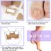 200 Pieces Ingrown Toenails Stickers Toenail Correction Patch Glue-Free Ingrown Curved Toenail Lifter Foot Care Treatment Pedicure Tool (A) - Buy Online on GoSupps.com