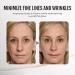 Youthful Lift Eye Firming Cream - Anti-Wrinkle Lifting Treatment for Smooth Fine Lines (3PCS) - Rejuvenate Your Skin - Buy Online on GoSupps.com