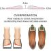 Dr. Foot Supination & Overpronation Insoles - Medial & Lateral Heel Cups for Foot Alignment, Knee Pain, Bow Legs, Osteoarthritis (Medium) - Buy Online on GoSupps.com
