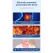 Herbal Breath Soothing Cough Relieving Patch It Is Suitable For Sub-health People Who Are Uncomfortable Due To Cough And Asthma. (Color : 2Count (Pack of 2)) - Buy Online on GoSupps.com