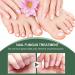 Antifungal Nail Treatment for Damaged Nails - Toe Care Solution for Renewing Discolored Feet - Buy Online on GoSupps.com