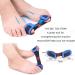 Toe Relax Set of 4 - Gel Toe Stretcher Separators & Bunion Corrector for Pain Relief & Relaxing Toes - International Shipping Available - Buy Online on GoSupps.com