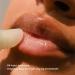 eos 24H Moisture Super Balm Watermelon Frose 10 ml(Packaging May Vary) pack of 1 - Buy Online on GoSupps.com
