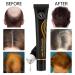 Hocossy Regrowth Organic Hair Serum Roller Set - Scalp Intense Hair Growth Treatment for Men & Women 20ml 3PCs - Natural Hair Care Solution - Buy Online on GoSupps.com