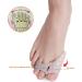 Barenx Gel Toe Separator - Bunion Hallux Valgus Corrector for Foot Care - Buy Online on GoSupps.com