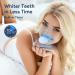 Teeth Whitening Kit Teeth Whitening Kit with LED Light - Teeth Whitening Kits Teeth Whitener Including Mouth Tray 12 Teeth Whitening Gels 3 Desensitizing Gels and Storage Case - Buy Online on GoSupps.com