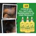 Rosemary & Black Caster Oil Hair Growth Serum | Organic Natural Oils for Breakage & Dry Scalp | Fast Results 2.0 fl oz All Hair Types - Buy Online on GoSupps.com