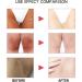 EXQST Dark Spots Correcting Cream Bleaching Cream for Dark Skin Bleaching Cream for Dark Spots Intimate Areas Lightening Cream Lightens the Dark Private Part - Buy Online on GoSupps.com