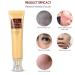 30g Scar Acne Mark Pimple Removal Cream - Blemish Treatment Ointment - Buy Online on GoSupps.com