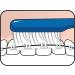 Tepe Special Toothbrush for Implants & Braces - Extra Narrow Brush Head | 2-Pack - Buy Online on GoSupps.com