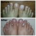Probelle Extra Strength Natural Nail Fungus Treatment 0.5 Fl Oz - Clinically Proven to Restore Nails from Fungus - Reduce Thickness & Restore Color - Pack of 1 - Buy Online on GoSupps.com