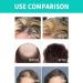 BOKIOESDE Dense Hair Growth Essence Roller Natural Ingredient Regrowth Anti-loss Nourishing Serum Haircare Beauty Supplies - Buy Online on GoSupps.com