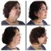 Bring It Up Instant Face Lift Tape Kit - 30 Day Supply | Neck and Eyebrow Lift Tapes - Transparent Strips for Wrinkle Reduction - Buy Online on GoSupps.com